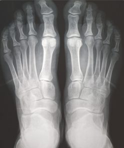 Basic Mobile X-ray 2