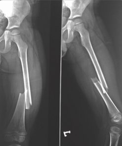 Ultra Mobile X-ray 3